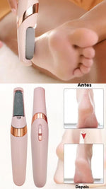 Charger l'image dans la galerie, SmoothFeet Pro
